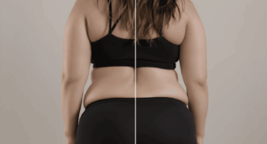 Cómo actúa realmente el drenaje linfático