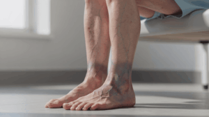 Por qué puede deteriorarse la circulación sanguínea